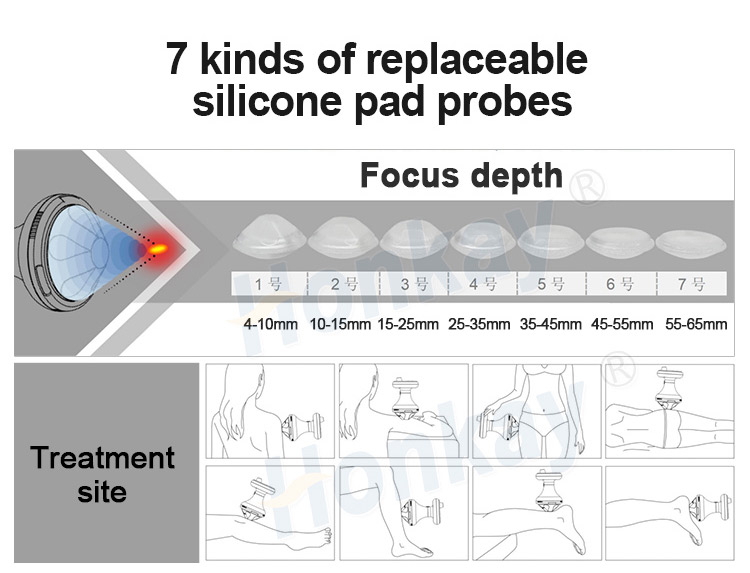 focus shockwave therapy