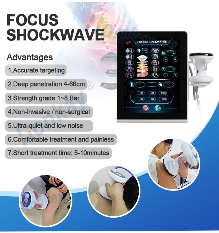 focus shockwave therapy